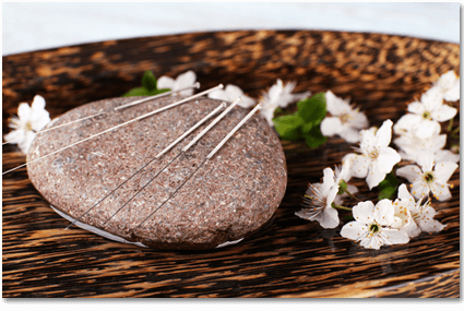 Acupuncture Wall Township