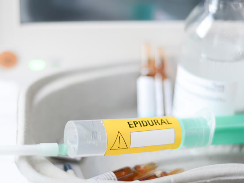 Epidurals