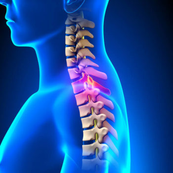 Neck Pain Doctor Wall Township
